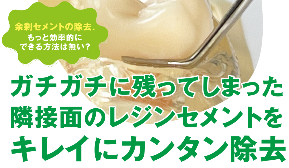 セメントール