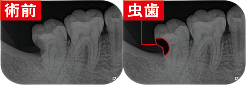 症例1