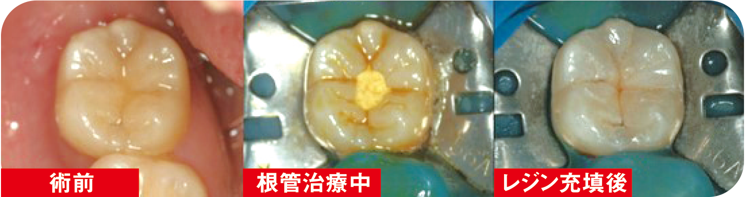 術前術後